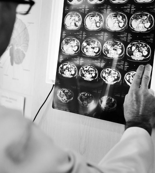 evansville traumatic brain injury lawyer brain scan