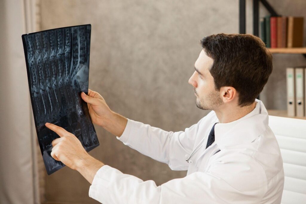 doctor looking at spinal cord scan