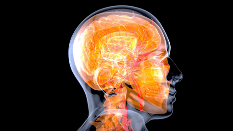 3D scan of human brain
