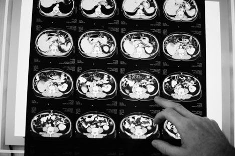 doctor pointing brain scans